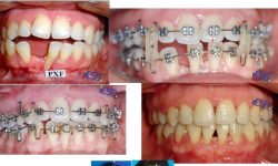 Caso 2 – Dra. Laura Carvalho