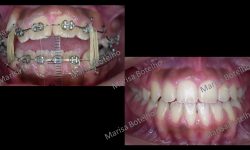 Caso 1 – Dra. Marisa Botelho