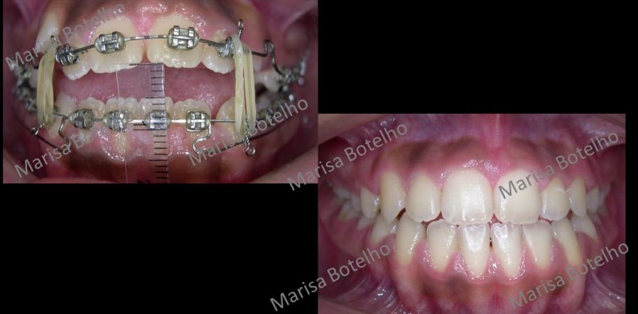 Caso 1 – Dra. Marisa Botelho