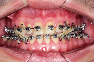 Caso 3 – Dr. Antônio Munhoz